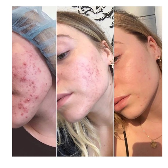 Dermalogica Daily Microfoliant Exfoliator NEW - Picture 6 of 9